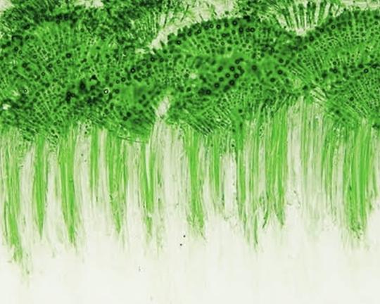 《会呼吸的痛》电影封面