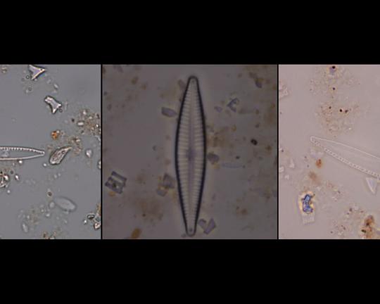 《Dance of Diatomee》动画封面