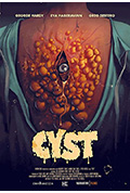 《囊肿》封面