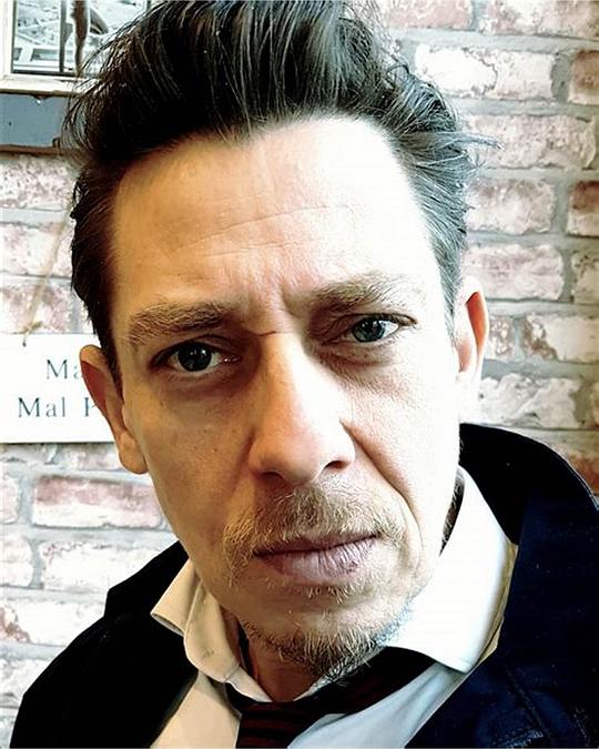 米尔顿·威尔士 Milton Welsh照片