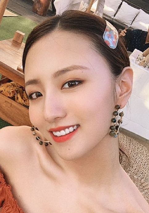 张伊君 Yijun Zhang照片