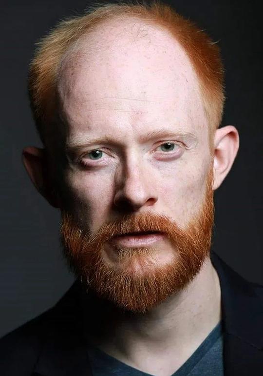 罗宾·贝里 Robin Berry照片